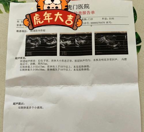 子宫后位如何提高受孕率（一起学习如何提高受孕率吧）