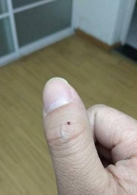 苹果手机后背出现黑点是怎么回事？